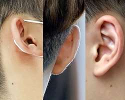 He has several small moles on his body.